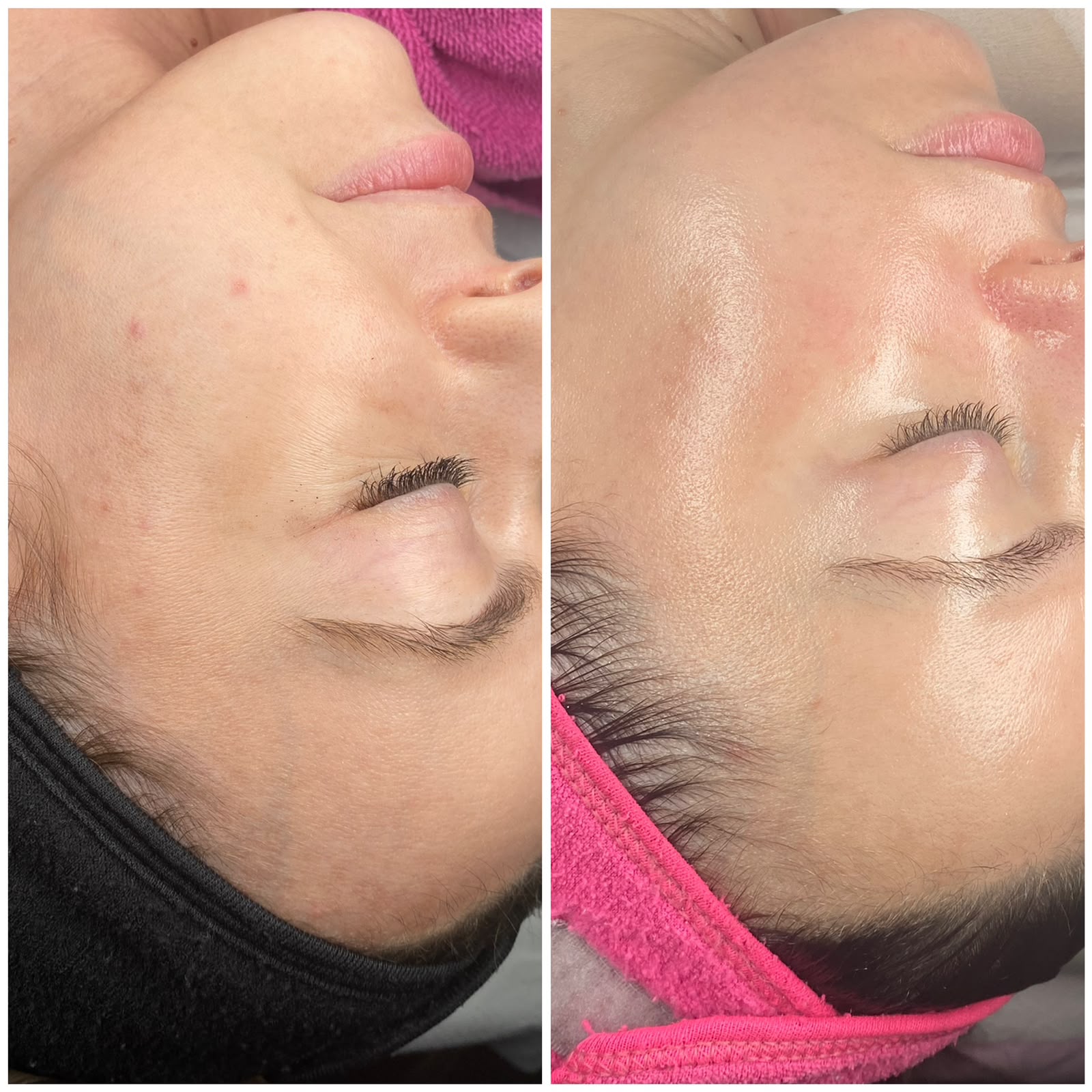 Dettaglio pelle e trattamento viso Mood Beauty Lab a Pavia