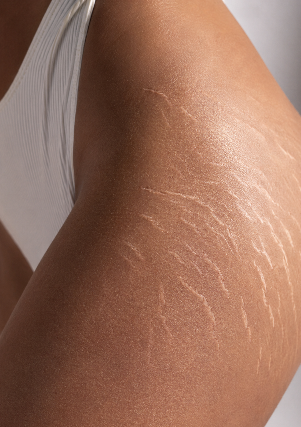 Goodbye Cellulite & Smagliature — trattamento corpo Mood