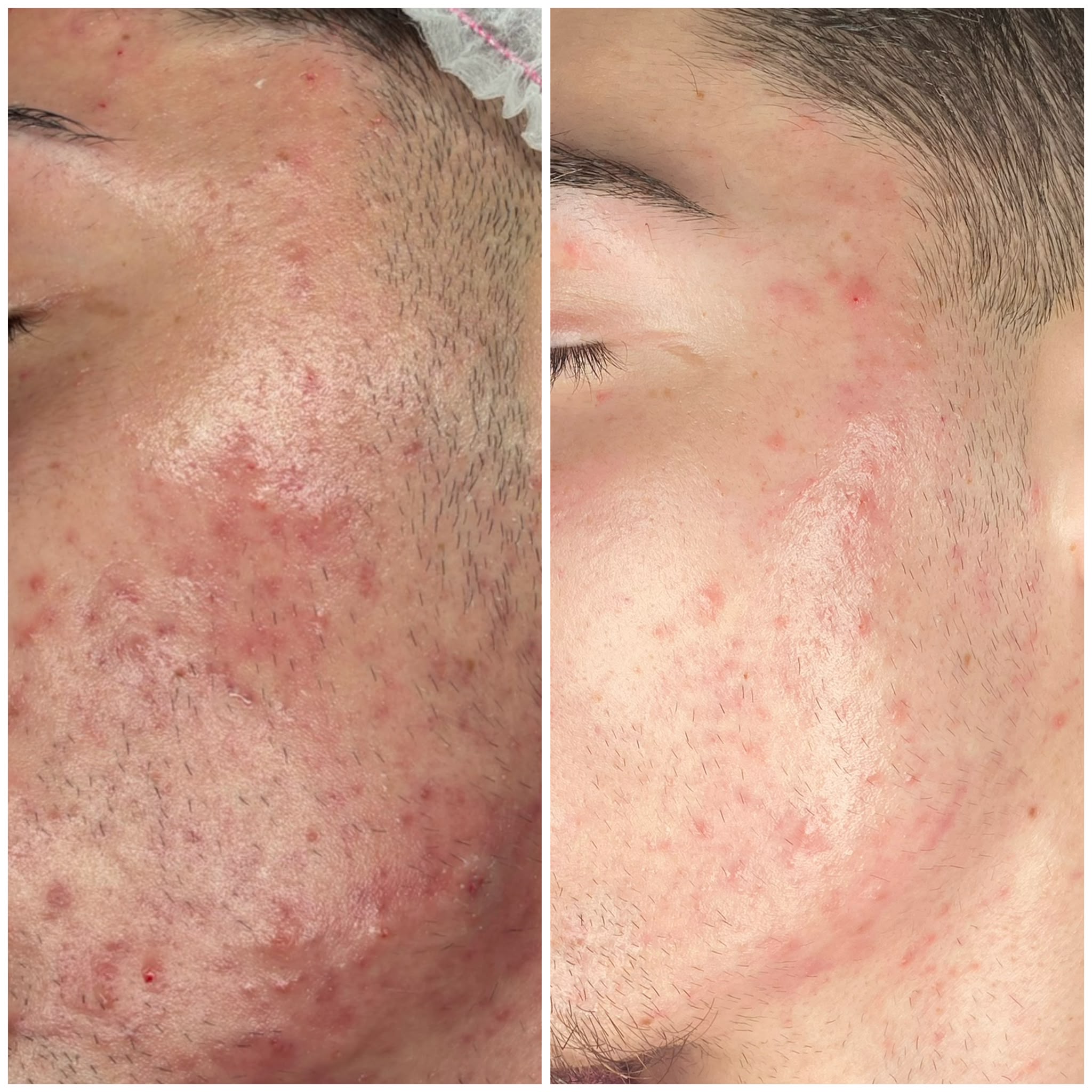 Risultato di un trattamento Mood Beauty Lab